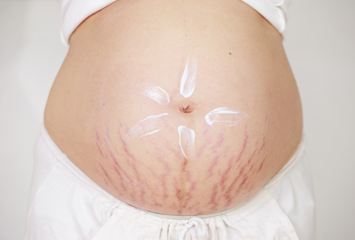 Việc mang thai dẫn đến những thay đổi gì về da trong thai kỳ