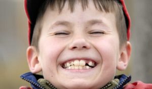 Tại sao răng mọc lệch? Giúp trẻ thay răng mọc lệch tại nhà